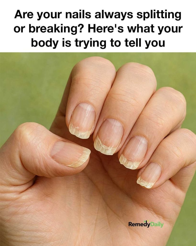 Are your nails always splitting or breaking? Here’s what your body is trying to tell you