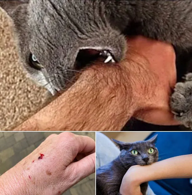 If the cat bites you, here’s what it really means