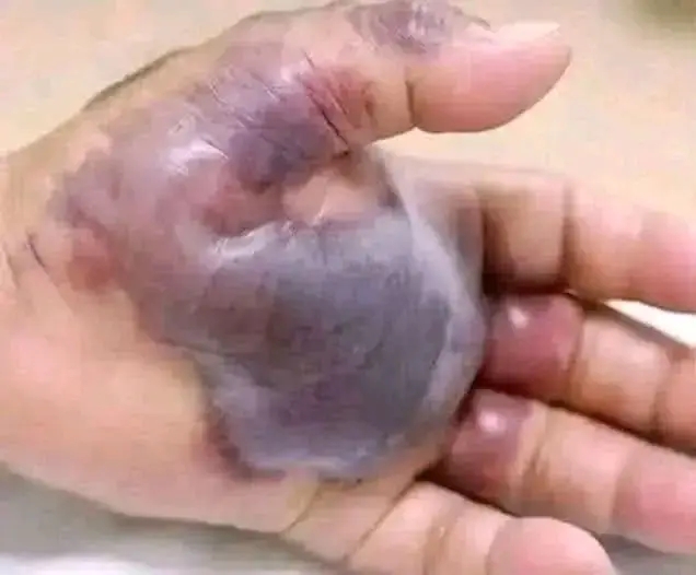 ATTENTION to these first signs of…See More