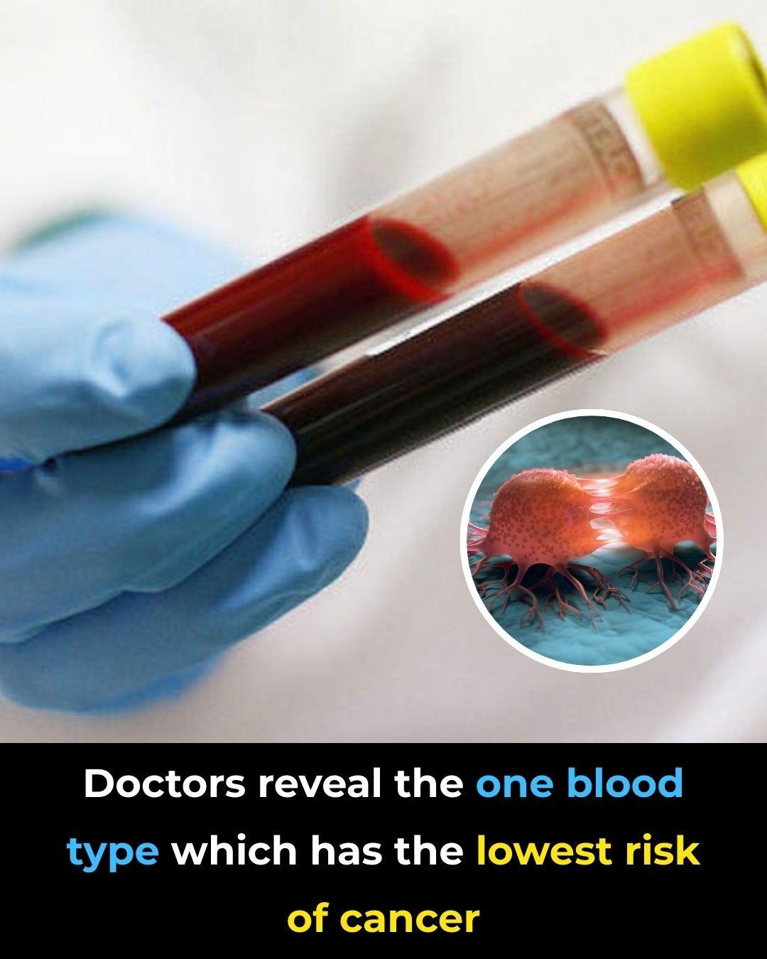 Understanding the Link Between Your Blood Type and Health