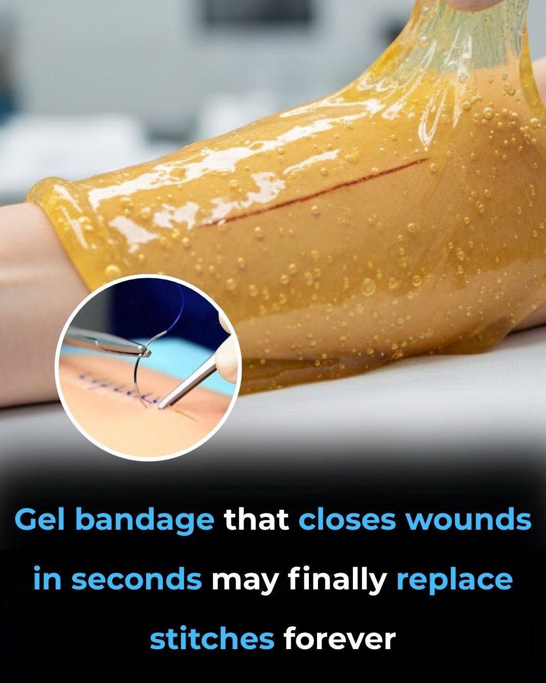 Discover how this groundbreaking gel bandage could revolutionize wound care—find out more in the comments!