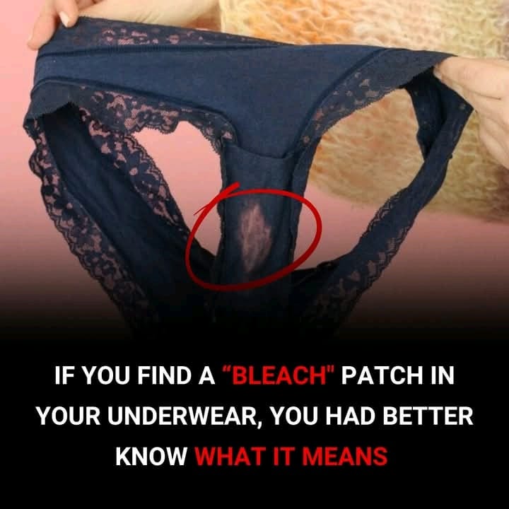 What a “Bleach” Patch on Your Underwear Means