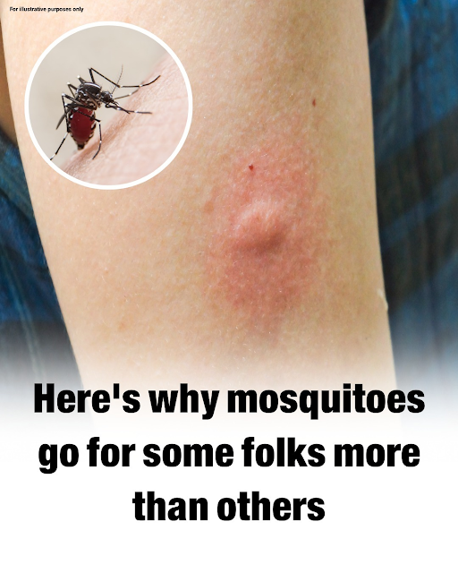 Here’s why mosquitoes go for some folks more than others