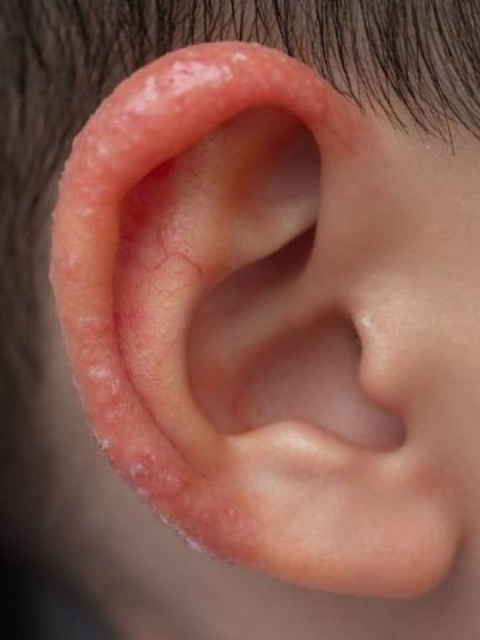 I noticed a strange patch of skin on my son’s ear this morning. His doctor appointment is still a week away — what should I do in the meantime?