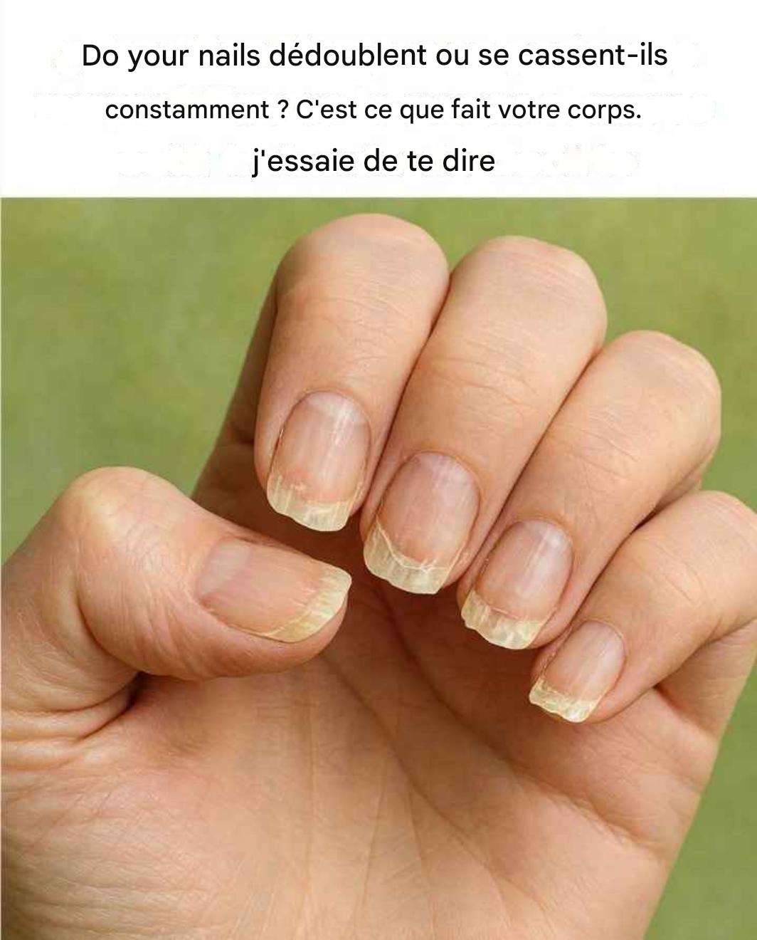 Are your nails constantly breaking or splitting? Here’s what your body is trying to tell you